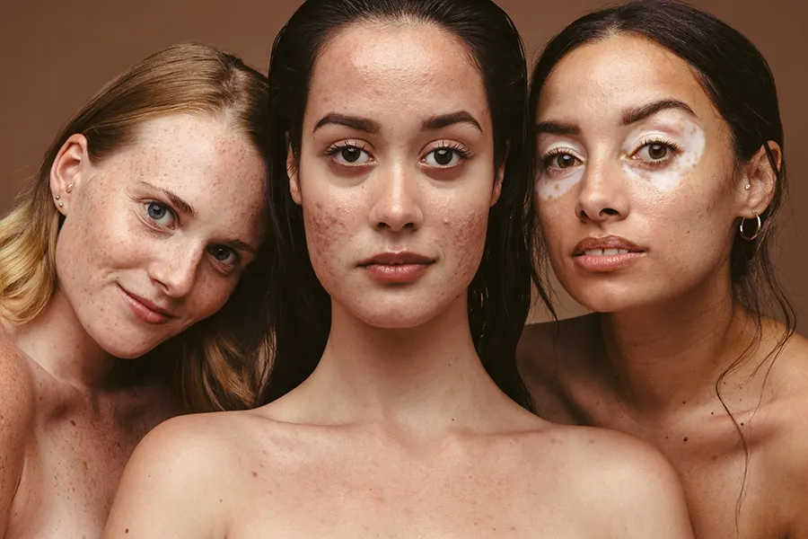 Skin 1