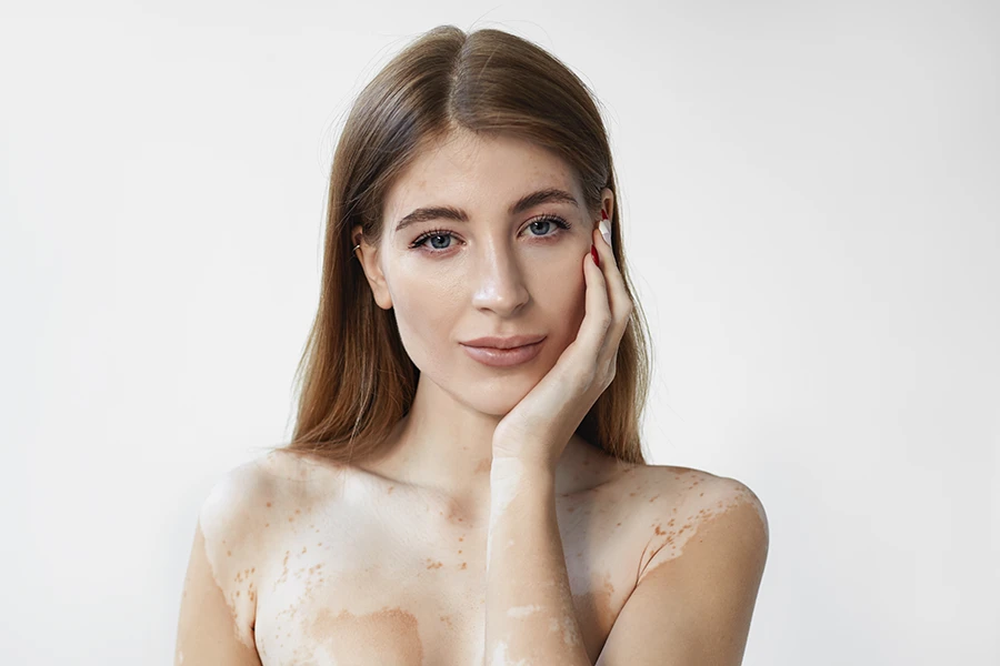 Skin 2